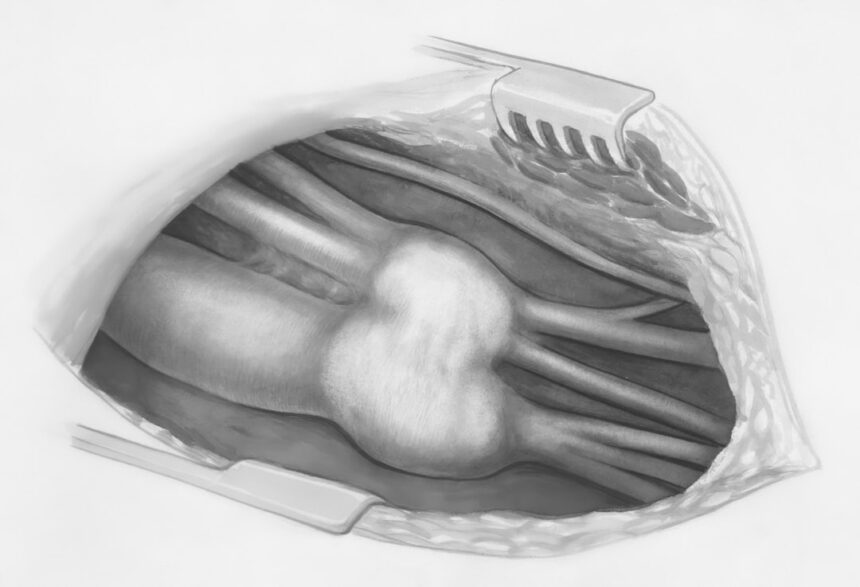 Photo basal ganglia automaticity