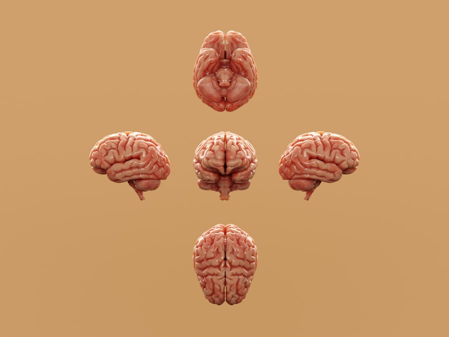 brain scans
