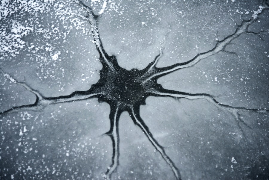 amygdala dominance