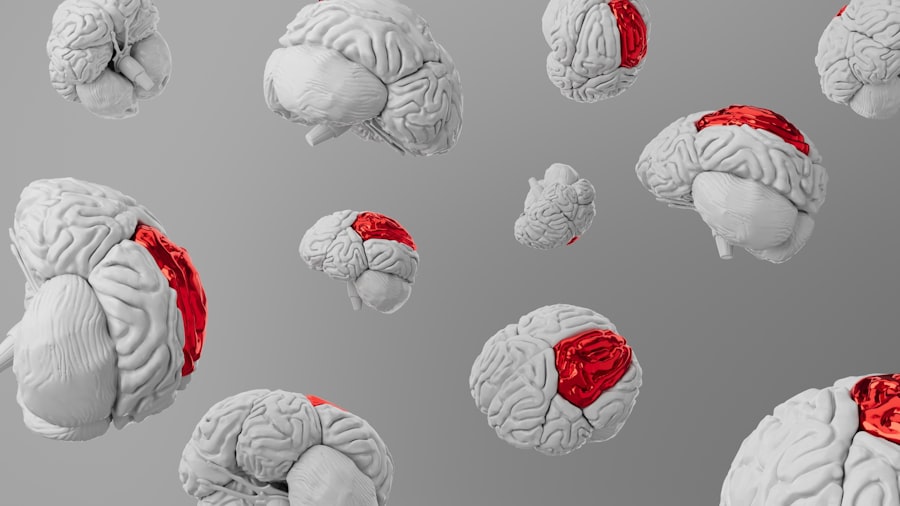brain cravings
