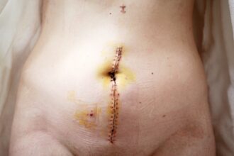 Photo scars into a professional edge