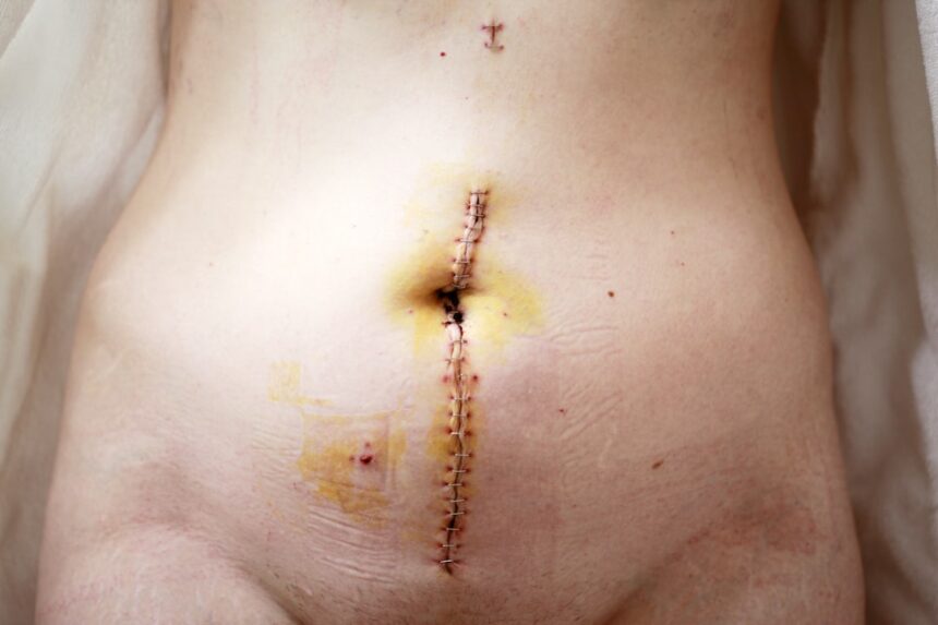 Photo scars into a professional edge